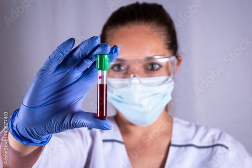 Hepatitis: análisis de una muestra de sangre en un laboratorio