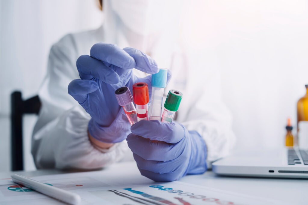 análisis de sangre: tubo de muestra en un laboratorio de investigación