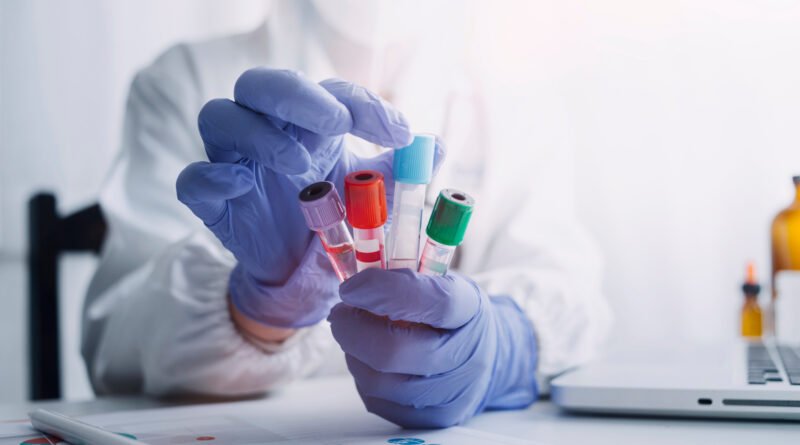 análisis de sangre: tubo de muestra en un laboratorio de investigación