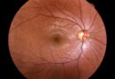 inteligencia artificial y diabetes: imagen médica de una retina