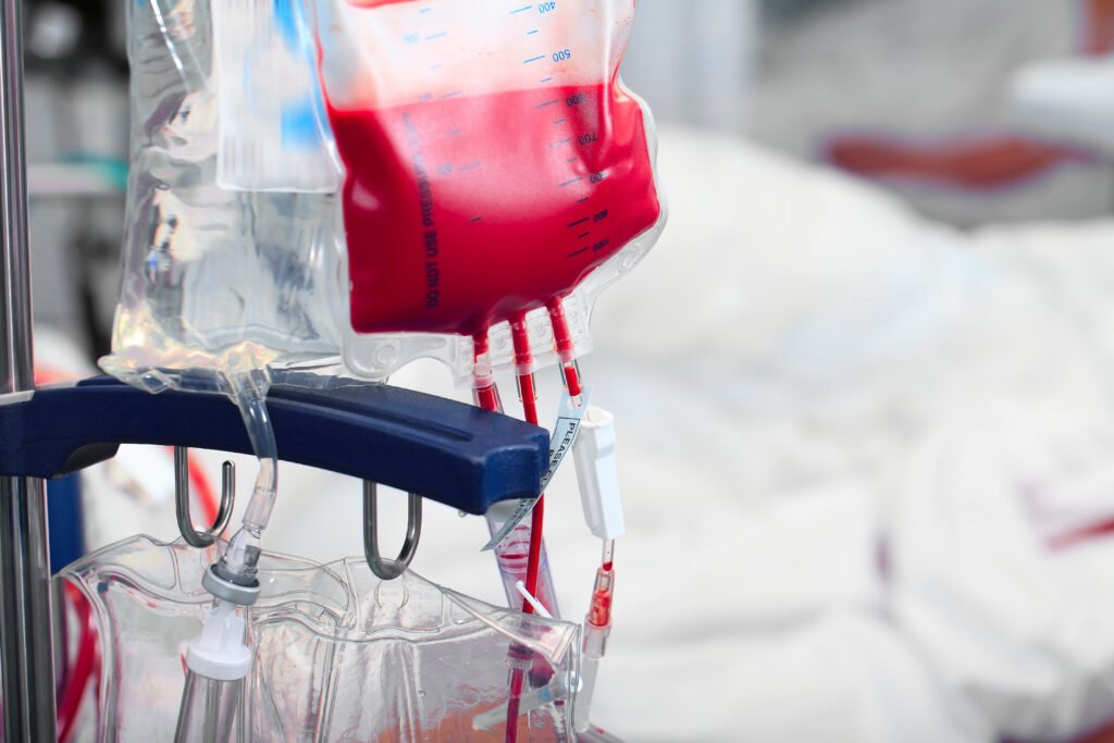 Testigos de Jehová: bolsa de sangre para transfusión en un hospital